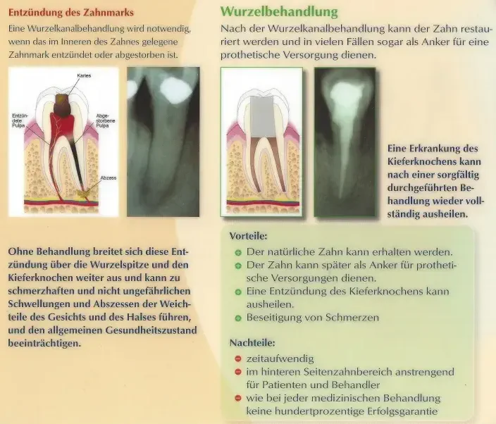 Endo2